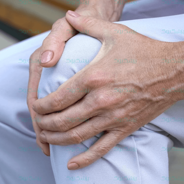 آرتروز،‌ عوامل خطر و راه های درمان آن