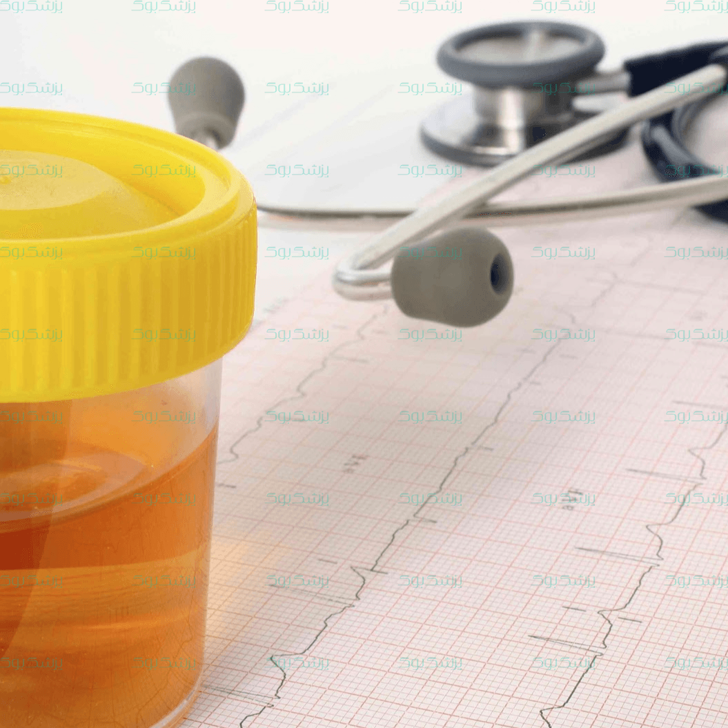 مشاهده خون در ادرار تا چه حد ترسناک است؟