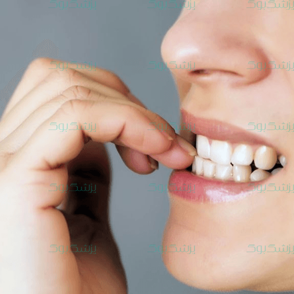 چرا ناخن می‌جویم؟!