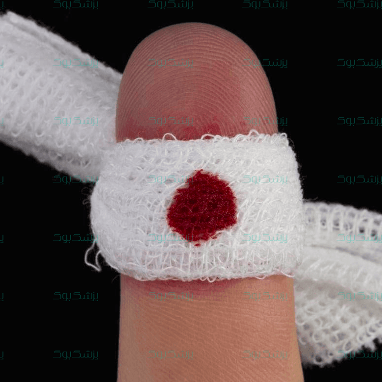 زخم بدن چیست؟ درمان خونریزی زخم بدن در منزل