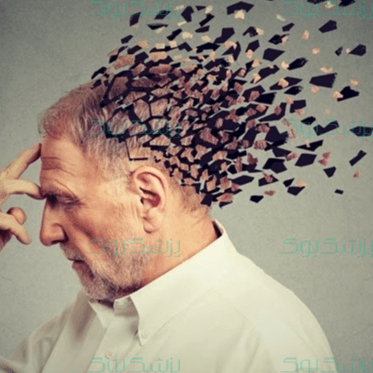 چگونه آلزایمر نگیریم؟