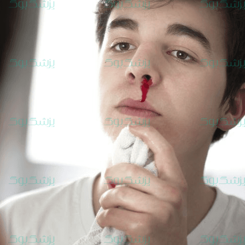 چرا خون دماغ می‌شویم؟