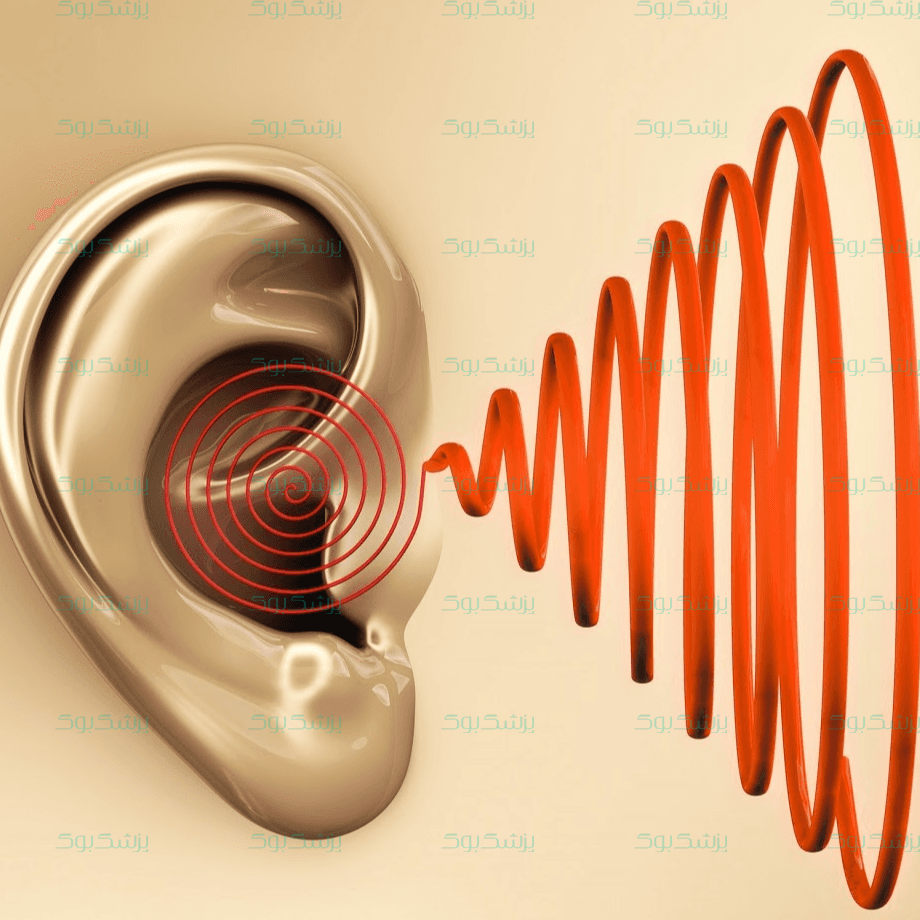 وزوز گوش؛ آیا گوشتان سوت می‌کشد؟