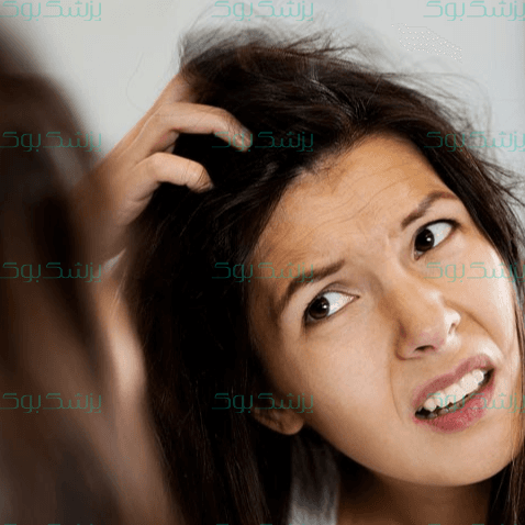 خارش پوست سر؛ خارش کف سر و راهکارهای مقابله با آن