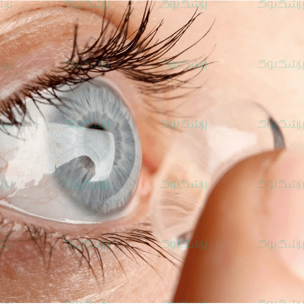 آیا می‌توانیم با لنز بخوابیم؟!