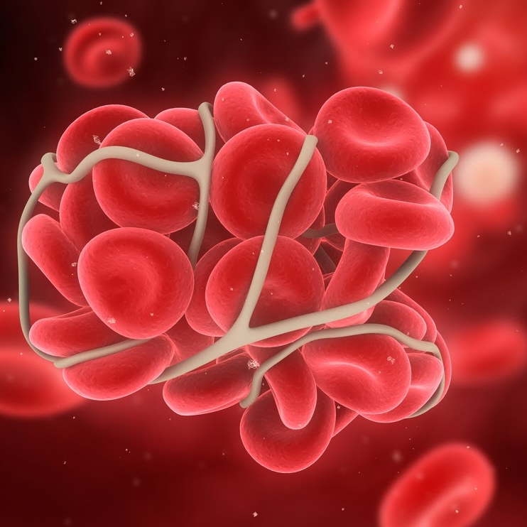 اختلال لخته شدن خون چیست و چرا ایجاد می‌شود؟