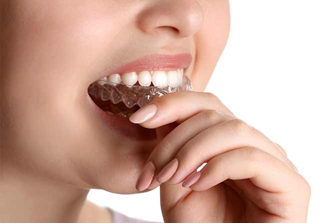 pezeshkbook.com - پزشک‌بوک - چرا دندان هایمان تیر می‌کش